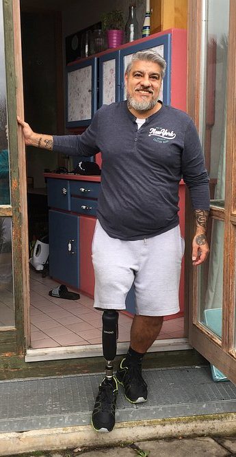 Joe Garcia mit seiner neuen Beinprothese von Blatchford