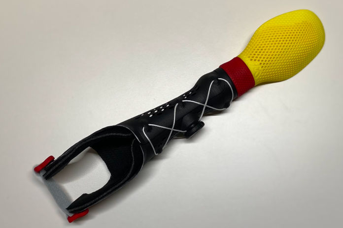 Das Foto zeigt eine Armprothese aus dem 3-D-Drucker mit Schwimmhilfe. 