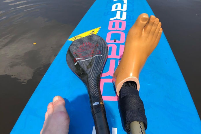 Ein SUP-Board, auf dem ein Paddel und ein Prothesenfuß zu sehen ist. Auch ein gesunder Fuß ist im unteren Teil sichtbar.