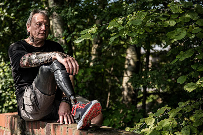 Ein Mann sitzt auf einer Steinmauer. Am rechten Bein trägt er eine Prothese inklusive eines Sportschuhs. Die Prothese ist angewinkelt. Darauf liegt sein rechter, tätowierter Arm. Im Hintergrund befinden sich Bäume und Blätter.