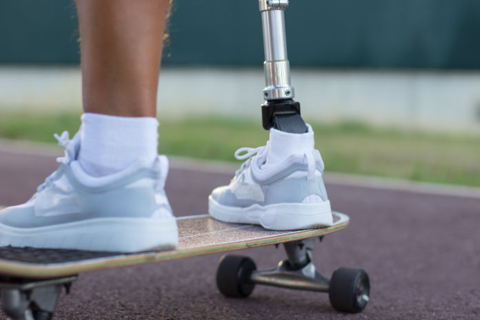 Zwei Füße auf einem Skateboard, ein Fuß besteht ist eine Prothese.