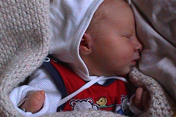 Ein Baby eingewickelt in eine Decke. An ihrer rechten Hand sind die Finger und der Daumen verkürzt. Eine Fehlbildung der Hand.