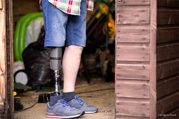 Ein Mann stehend in einem Holzschuppen. Er trägt am rechten Bein eine Unterschenkelprothese. Darüber einen kurzen, blauen Strumpf.