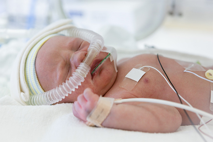 Ein kleines Baby mit einem Sauerstoffschlauch in der Nase und diversen Kabeln am Körper. Die Augen sind geschlossen, es trägt eine Mütze. 